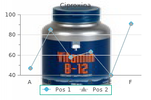 discount ciproxina 750 mg on line