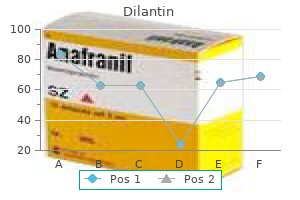 order dilantin 100 mg fast delivery