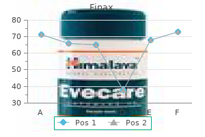 buy generic finax 1 mg on-line