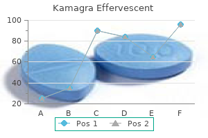 buy discount kamagra effervescent 100 mg