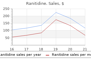 buy ranitidine 300 mg with visa