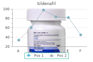 purchase 50 mg sildenafil amex
