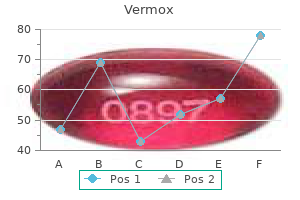 vermox 100 mg sale